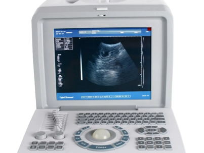 Digital Portable Full Ultrasound Machine Oriel Plus