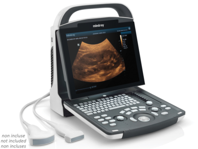 Digital Ultrasonic Diagnostic Imaging System DP-10