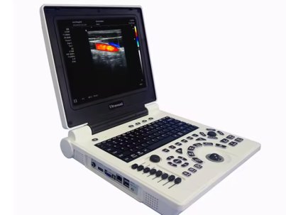 Ultrasound Machine Laptop Ultrasonic Diagnostic System Portable