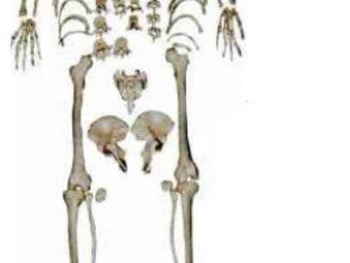 XC-130_Disarticulated_Human_Skeleton__Bilateral_
